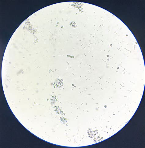 bacterial dna integrity after autoclaving